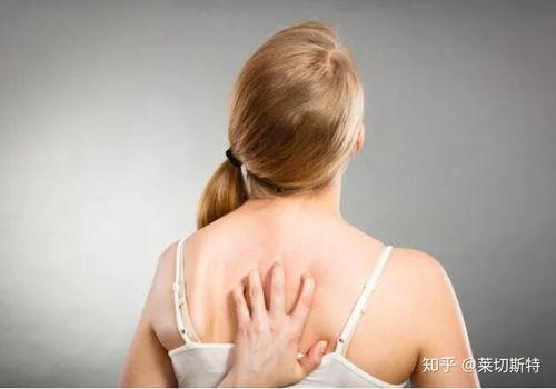过敏皮炎图片大全,常见症状与预防措施