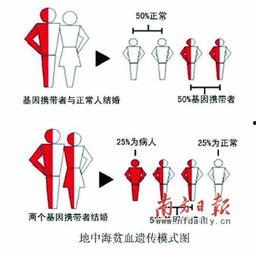 地中海贫血人图片大全,图解疾病症状与影响
